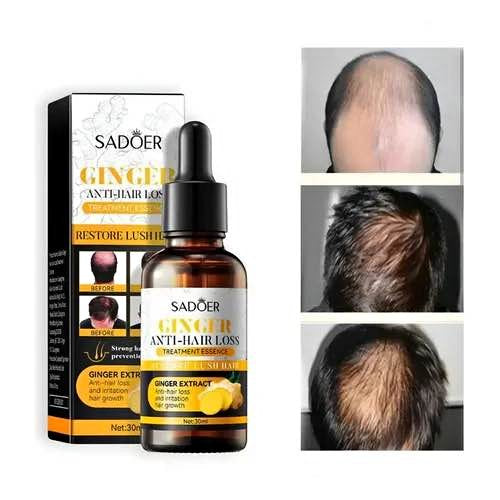 Huile-Pousse De Cheveux